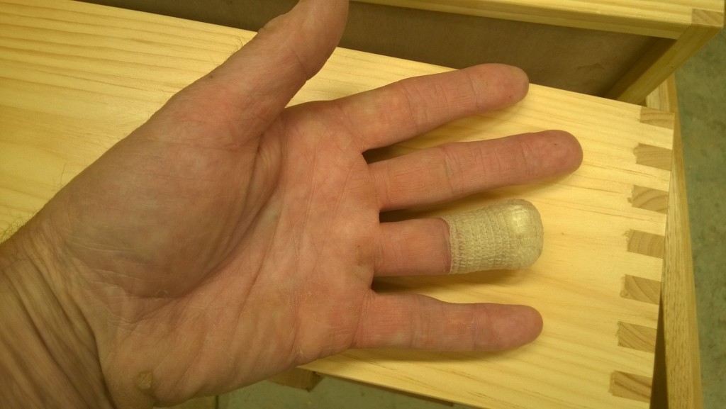 One month into the program, and my finger still has not grown back. It is, however, mostly healed, and I'm looking forward to showering without a plastic bag over my hand.  My shop safety awareness is sky high. My typing is in the toilet.